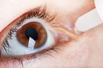 La conjuntivitis puede provocar enrojecimiento del ojo.