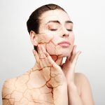 La piel atópica: síntomas, causas y tratamiento