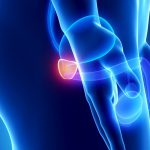 La prostatitis: tipos, causas y tratamiento