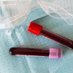 ¿Qué importancia tiene la analítica de sangre?