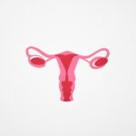 ¿Cómo afectan a la fertilidad los ovarios poliquísticos?