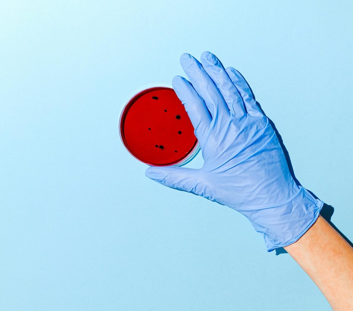 Algunas bacterias suponen una amenaza global